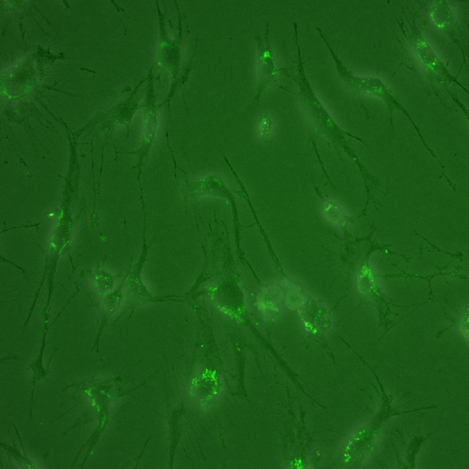 What’s new in exosome research? Here are a few of the recent papers we’re most excited about