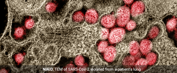 Coming Soon! Research tools for studying SARS-CoV-2, the virus behind the COVID-19 pandemic