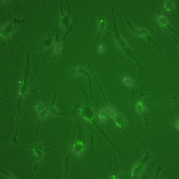 What’s new in exosome research? Here are a few of the recent papers we’re most excited about