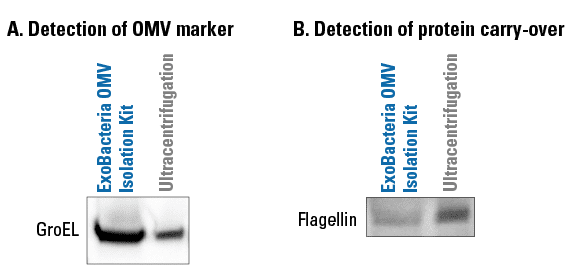 Get higher OMV yields and less carryover protein with the ExoBacteria OMV Isolation Kit