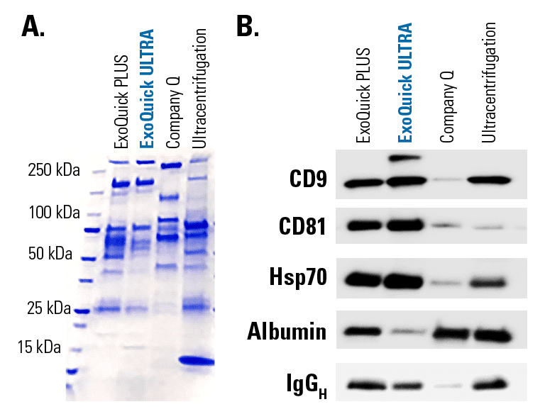 ExoQuick ULTRA delivers high yields of clean exosomes