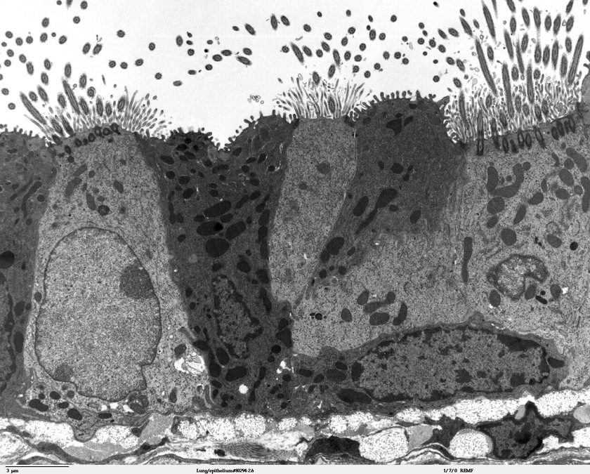 TEM of bronchiolar epithelium of the lung (mouse) – Louisa Howard and Michael Binder, Wikimedia Commons