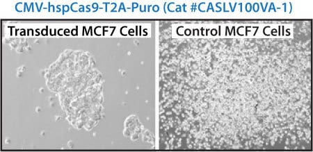 Phase images of Cas9 lentivirus transducing the cancer cell line MCF-7