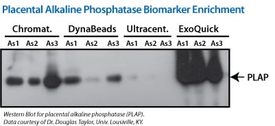 ExoQuick delivers high concentrations of exosomal proteins