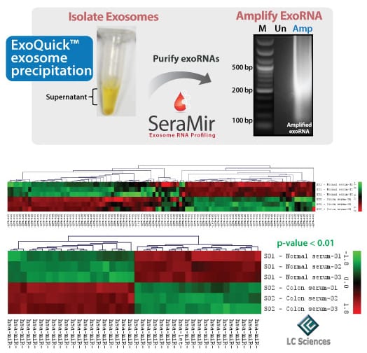 SeraMir provides reliably better qPCR profiling than exosmal RNAs isolated using phenol/trizol