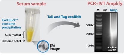 Find exosomal RNA biomarkers using the SeraMir Exosome RNA Amplification Kit