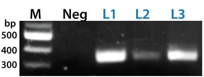 The PinPoint Integrase mediated specific placement of the PinPoint Donor Vector