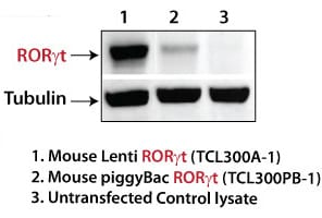 SBI’s human and mouse RORγt lentivector and PiggyBac plasmids provide robust RORγt overexpression