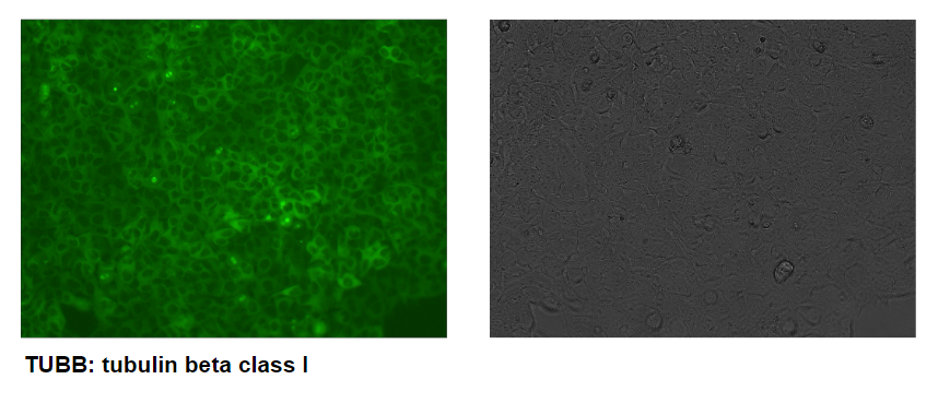 Tagging of endogenous TUBB with GFP