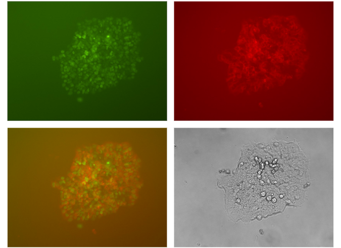 Dual Tagging of H4C3 and TUBB with different fluorescent tags sequentially