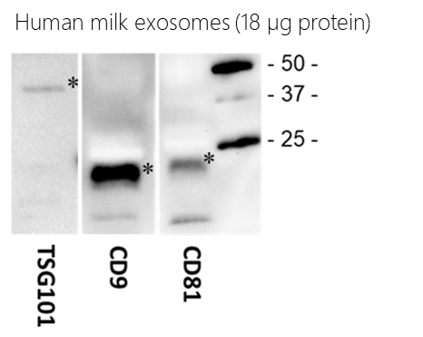 SBI’s Biofluid Exosomes contain expected protein markers as shown via Western blot analysis. The amount of protein loaded on each gel is as indicated
