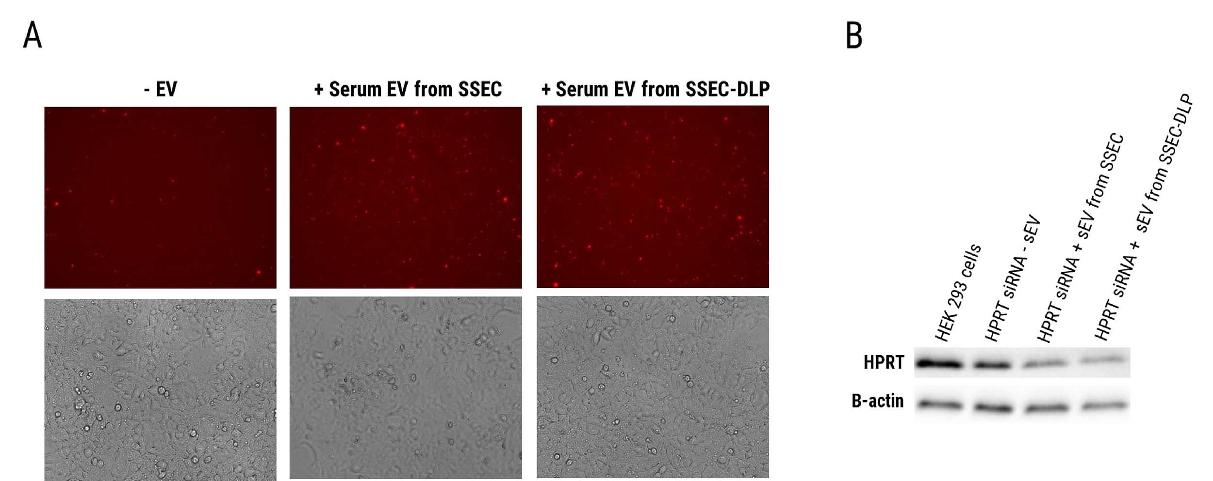 SmartSEC-DeLipo™ isolate sEV is biological functional