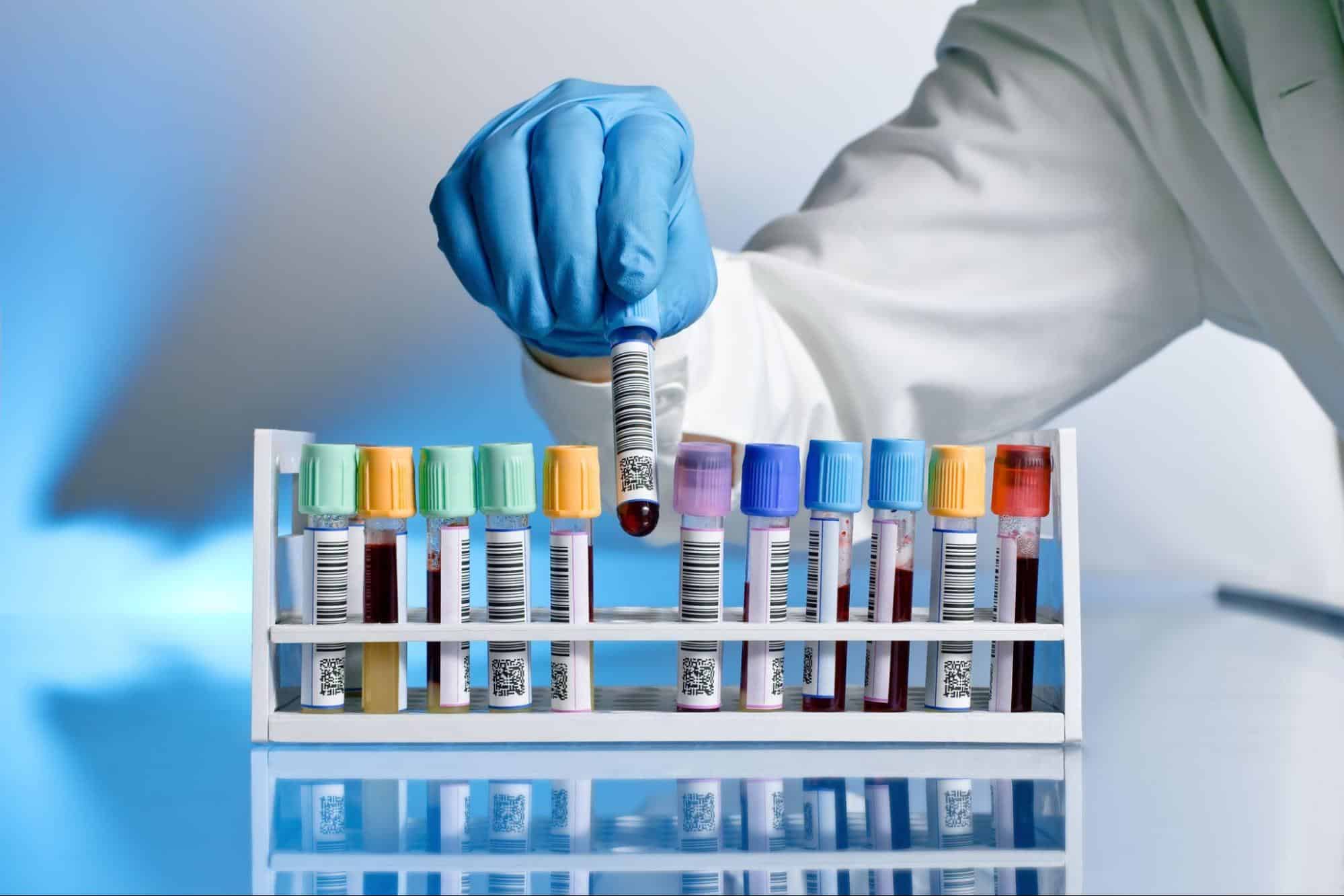 Blood sample tubes in laboratory rack