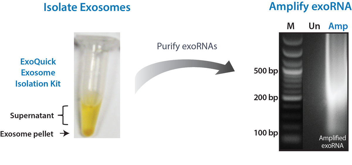 ExoQuick Exosome Isolation and RNA Purification Kit provides reliably better qPCR profiling than exosmal RNAs isolated using phenol/trizol