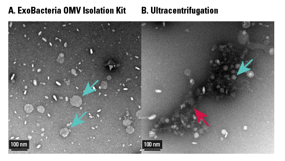 OMVs isolated using the ExoBacteria OMV Isolation Kit are similar in appearance, but with tighter distribution than OMVs isolated via ultracentrifugation
