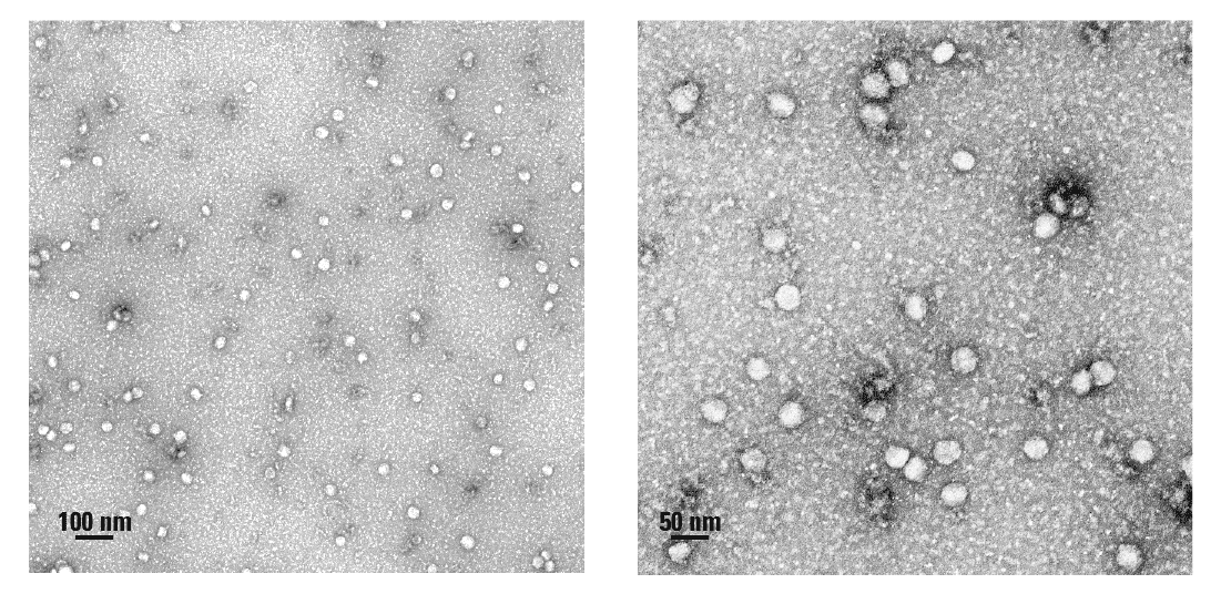 SmartSEC Mini provides robust isolation of EVs from 100 µL of Planaria neoblast culture media.