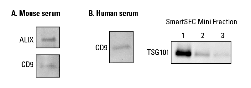 SmartSEC Mini delivers robust isolation of EVs from human and mouse serum.