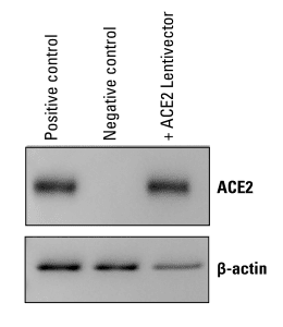 pCDH-CMV-ACE2-EF1α-Puro delivers robust ACE2 expression in HEK293 cells