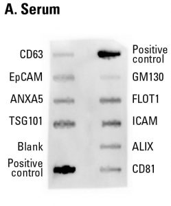 Streamlined, semi-quantitative, serum-derived exosome detection with Exo-Check Exosome Antibody Arrays