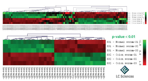 ExoQuick Exosome Isolation and RNA Purification Kit provides qPCR profiling