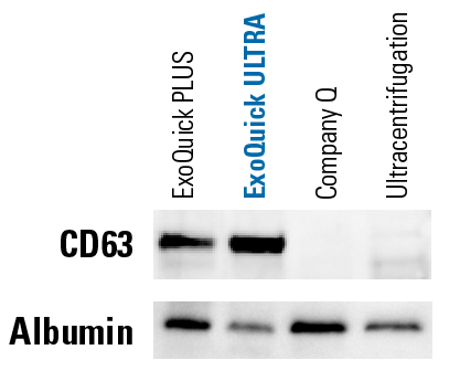 ExoQuick ULTRA delivers high yields of clean exosomes