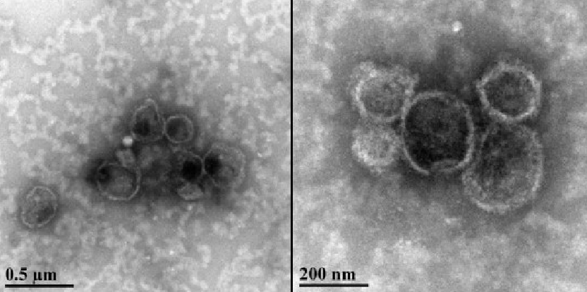 EVs isolated using ExoQuick ULTRA display typical EV morphology