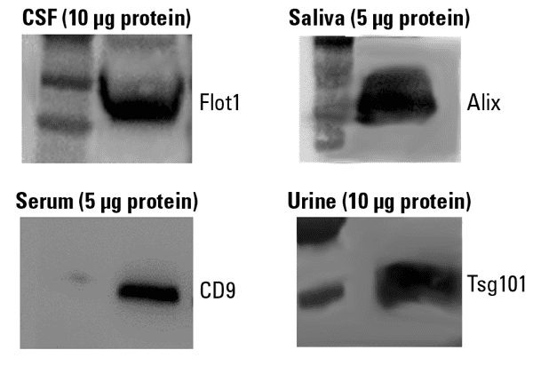 SBI's Biofluid Exosomes contain expected protein markers as shown via Western blot analysis