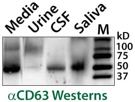 ExoQuick-CG delivers particles that carry the exosome marker CD63