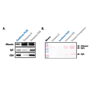 ExoQuick Plus delivers less carryover protein than other isolation kits