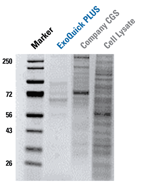 ExoQuick-TC PLUS delivers cleaner exosome preps than other kits