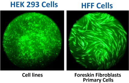 Retrovirus particles concentrated with Retro-Concentin are non-toxic and effective at transduction